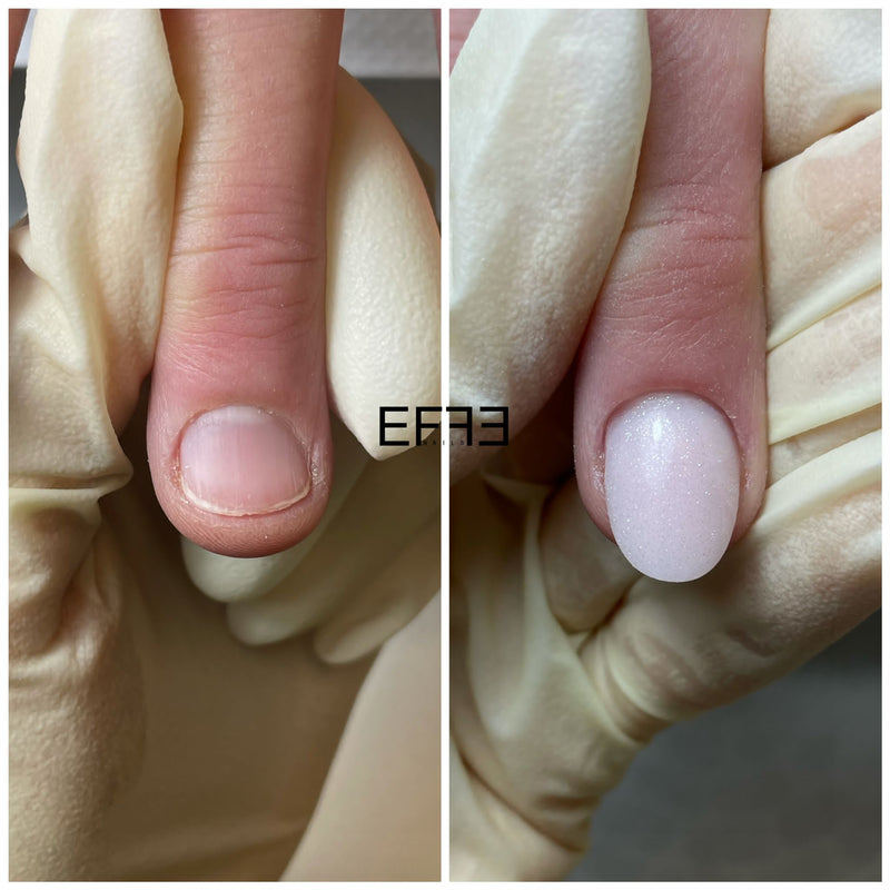 Onychophagia course