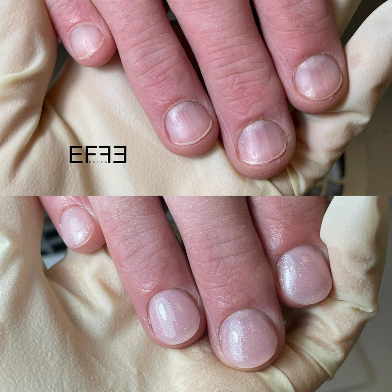 Onychophagia course